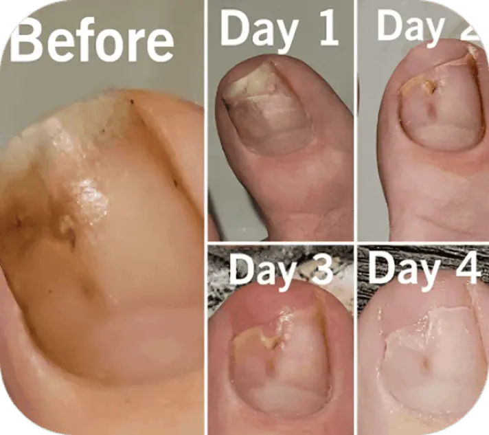 Fungabeam review Drew A.